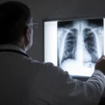 Journée mondiale de lutte contre la tuberculose 24 mars