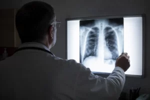 Journée mondiale de lutte contre la tuberculose 24 mars