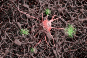 Journée mondiale de la maladie d'Alzheimer